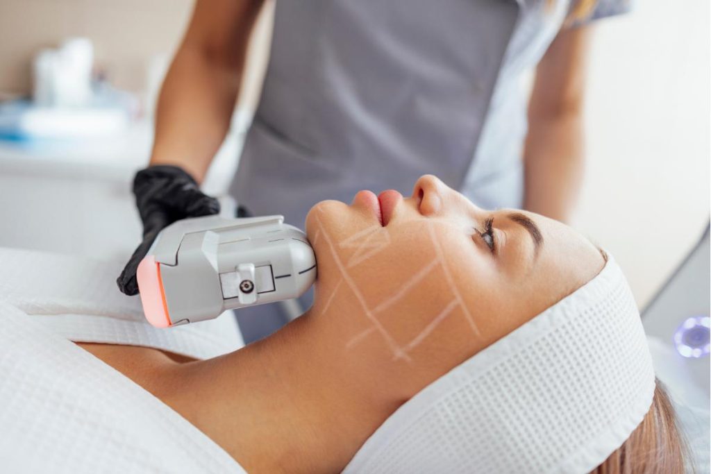 HIFU Face Lift Treatment in Dubbo